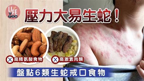 蛇煙禁忌|【生蛇戒口】食炸雞助熱生火、飲珍珠奶茶易傷正氣 或增生蛇機會